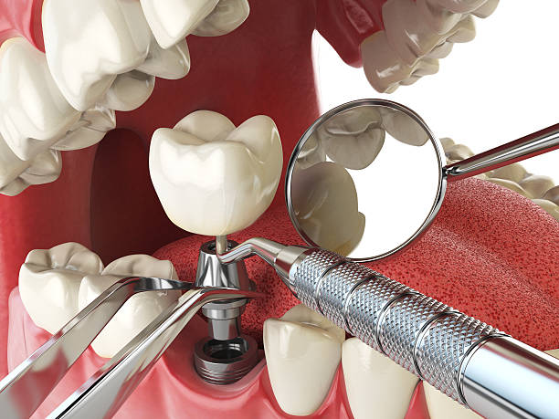 Best Emergency Treatment for Toothache in Cusseta, GA